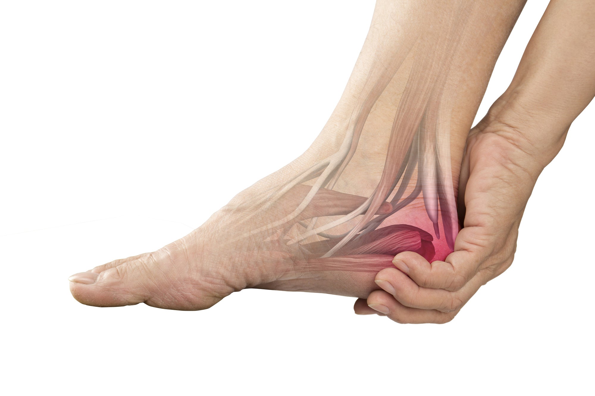 Understanding Morton's Neuroma and Finding Relief