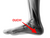 So You Have Heel Pain - Are Orthotic Insoles Really The Answer?